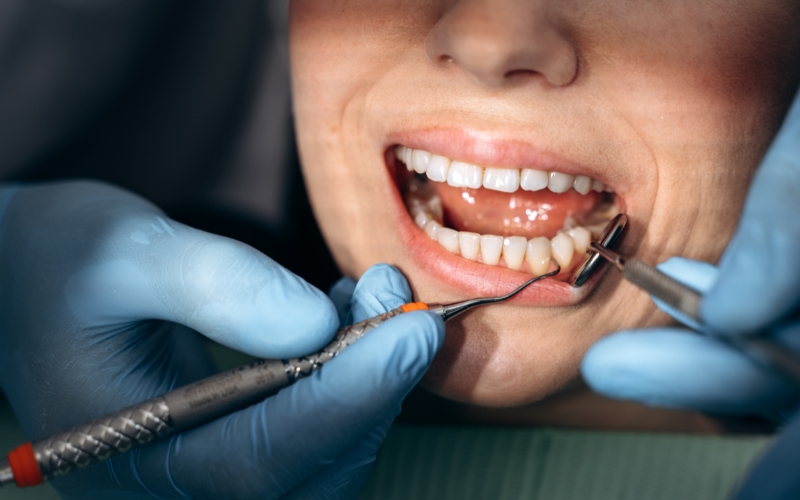Gum Disease Treatment