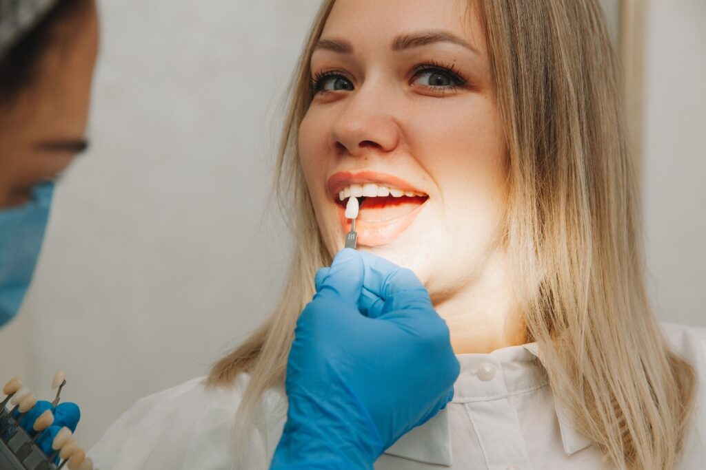 no-prep veneers are transforming dental aesthetics
