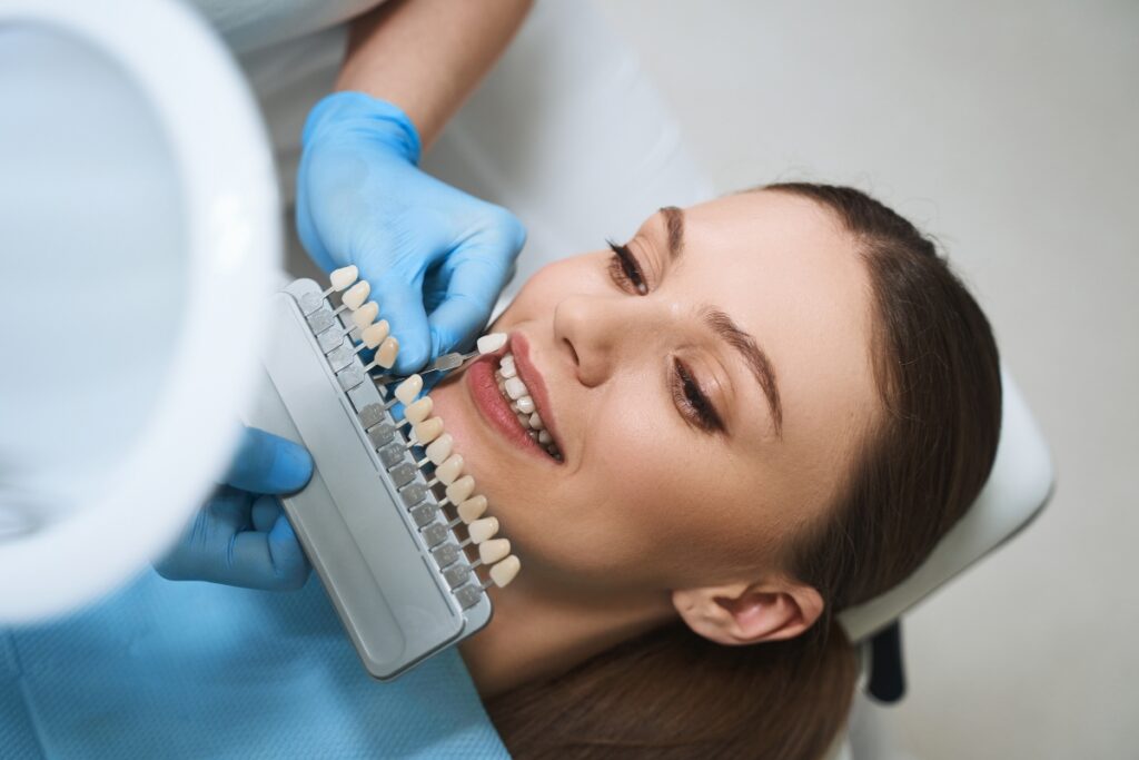top 5 benefits of choosing no-prep veneers for a natural-looking smile