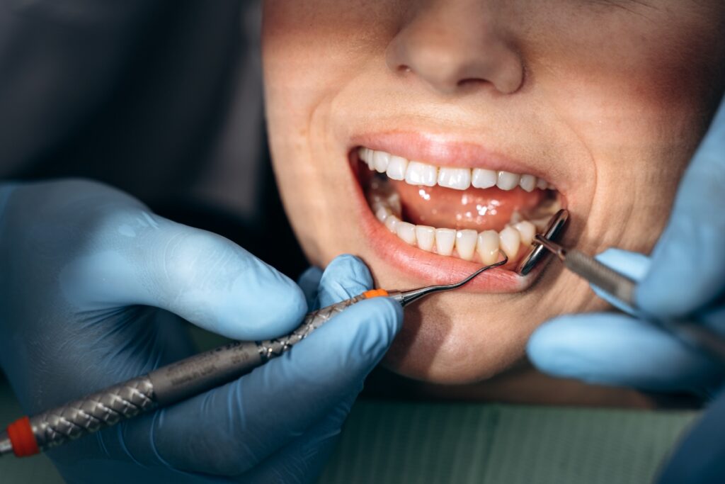 gum contouring in oklahoma city