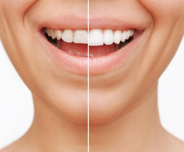 405 Dental Aesthetics