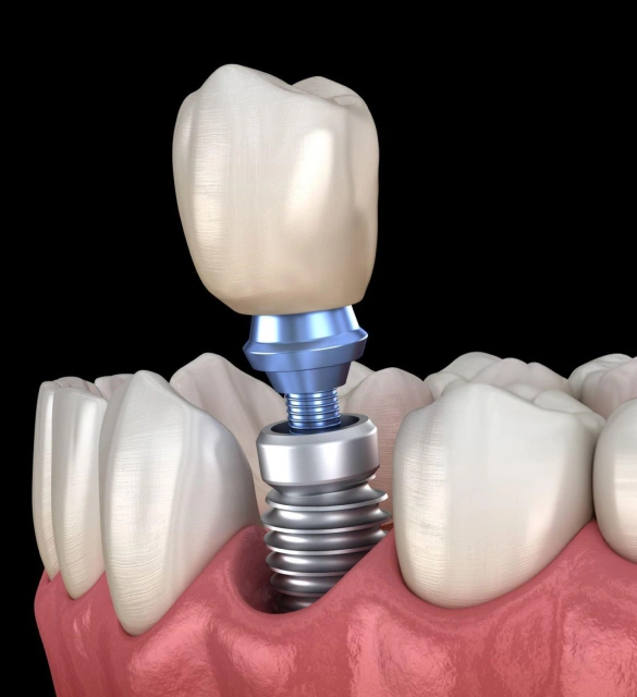 405 Dental Aesthetics