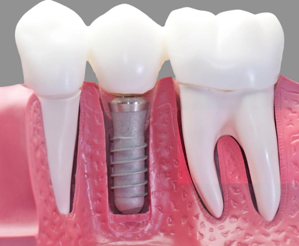 405 Dental Aesthetics