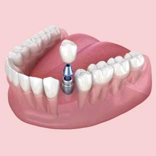 405 Dental Aesthetics
